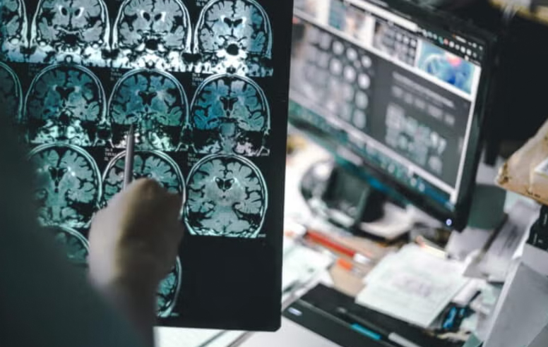 Person off screen looking at brain scans, with a computer desk in the blurred in the background